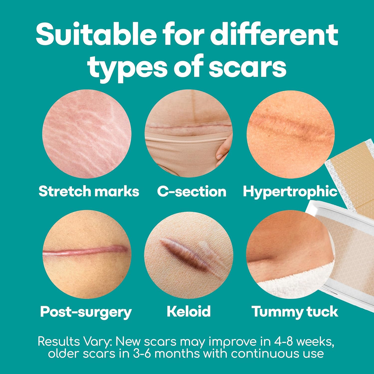 Silicone Scar Sheets, 80 Inches Long - Reusable Silicone Scar Tape - Includes Hygienic Storage Case D70791